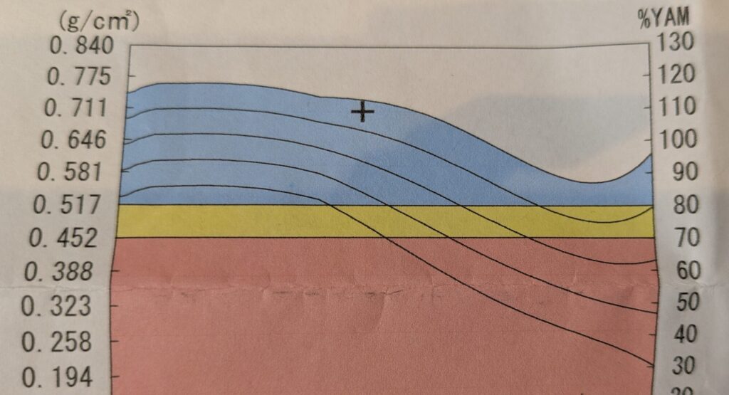 骨粗鬆症検診の結果